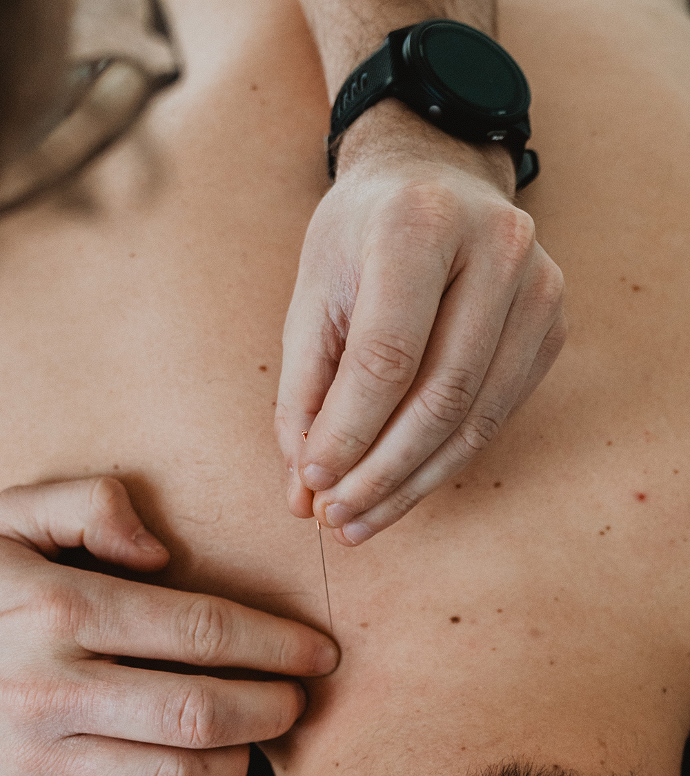 Myofasciale therapie